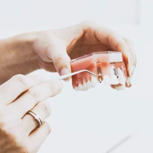 terapia-endodontica-bg