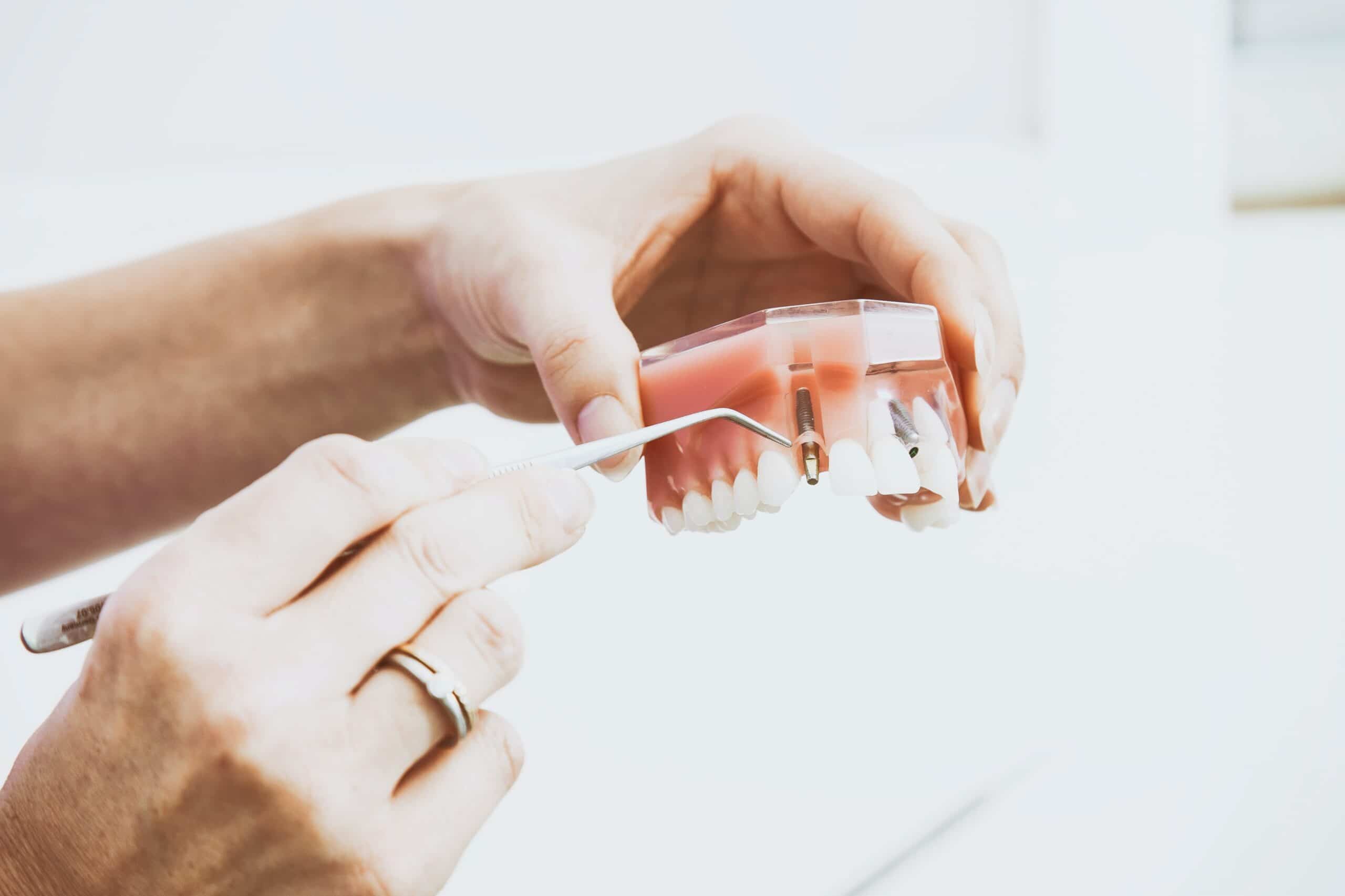 terapia-endodontica-bg